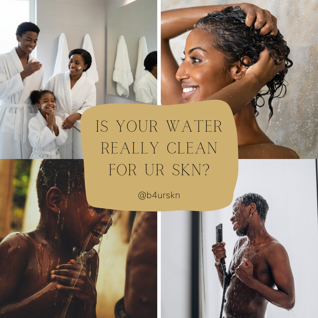 Why a Shower Water Filter Is Essential for Healthy, Glowing Skin